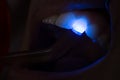 Dental UV light equipment pressed on teeth