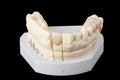 Dental wax model Royalty Free Stock Photo