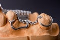 Dental wax model Royalty Free Stock Photo
