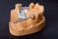 Dental wax model