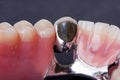 Dental wax model Royalty Free Stock Photo