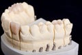 Dental wax model Royalty Free Stock Photo