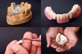 Dental wax models