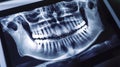 Dental X-ray Image of Human Teeth and Jawbone on Display Screen Royalty Free Stock Photo