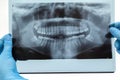 Dental X-ray. Radiography Royalty Free Stock Photo