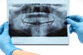 Dental X-ray. Radiography Royalty Free Stock Photo