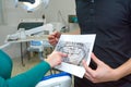 Dental X-rays and hands. Healthcare and medical.