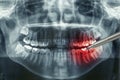 Dental xray