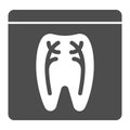 Dental xray solid icon. Tooth xray vector illustration isolated on white. Orthodontic roentgen glyph style design