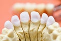 Dental zircon / pressed ceramic Royalty Free Stock Photo