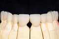 Dental zirconia bridge Royalty Free Stock Photo