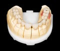 Dental zirconia bridge Royalty Free Stock Photo