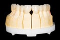 Dental zirconia bridge