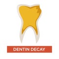 Dentin decay isolated dental care and medicine dentistry