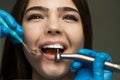 Dentist in blue gloves filling the beautiful smiling woman patient`s root canal under the medical lamp in clinic close up, Royalty Free Stock Photo