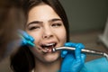 Dentist in blue gloves filling the beautiful smiling woman patient`s root canal using mirror under the medical lamp in clinic