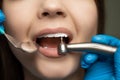 Dentist in blue gloves filling the patient`s root canal under the medical lamp in clinic close up, healthcare concept