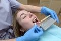 Young woman in dental office checking and matching teeth color Royalty Free Stock Photo