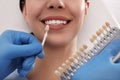 Dentist checking young woman`s teeth color in clinic, closeup Royalty Free Stock Photo