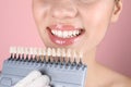 Dentist checking young woman`s teeth color