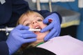 Dentist Clean Royalty Free Stock Photo