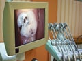 At the dentist - close up