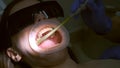 Dentist collects salivas with a saliva ejector in woman's oral cavity.