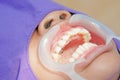 A dentist / dental technician placing the fixed pa Royalty Free Stock Photo