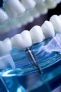 Dentist dental teeth implant