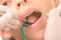 At the dentist -diagnosis- close up