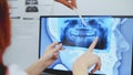 Dentist doctor checking dental x-ray orthopantomogram. Dental panoramic radiography