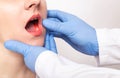 Dentist doctor examines the bite of the jaw of a girl and a bad tooth with pulpitis, gum disease, close-up, fluorosis