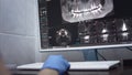 Dentist doctor examines a panoramic x-ray of the jaw on a computer screen. Diagnostic equipment for teeth in a modern