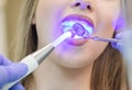 Dentist doing procedure with dental curing UV light in clinic