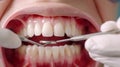 Dentist examines patient\'s teeth,closeup teeth Royalty Free Stock Photo