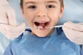 Dentist examining cute boy`s teeth