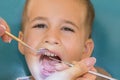 Dentist examining little boy& x27;s teeth in clinic. Close up of boy having his teeth examined by a dentist. A child at the dental Royalty Free Stock Photo