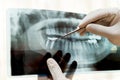 Dentist examining panoramic dental x-ray Royalty Free Stock Photo