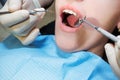 A dentist examining a patientÃ¢â¬â¢s teeth in the dentistry. A close-up of a patientÃ¢â¬â¢s teeth and mouth