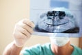 Dentist Examining X-Ray Royalty Free Stock Photo