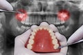 Dentist hand simulates dental surgery