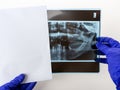 Dentist hands take the panoramic facial x-ray image out of the paper envelope. Original black white x-ray teeth scan of an old