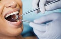 Dentist, healthcare and hands, patient mouth and medical tools, surgery and dental health. Tooth decay, orthodontics