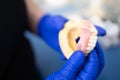 Dentist holding an artificial lower jaw. Dental Prosthesis. Zirconium porcelain tooth plate. Prosthetics work