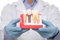 Dentist holding educational model of dental implant on white background, closeup