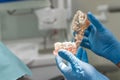 Dentist holding jaw with implanted teeth close up