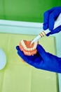 Dentist holding teeth model denture, showing with diagnostic periodontal probe