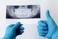 Dentist holds photo of teeth in his hands