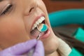 Dentist identifying cavities in mouth of patient Royalty Free Stock Photo