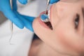 Dentist identifying cavities in patient teeth Royalty Free Stock Photo